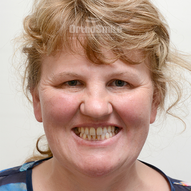 1METAMORFOZY_FOTO_DOROSLI_01_PRZED-PO_1