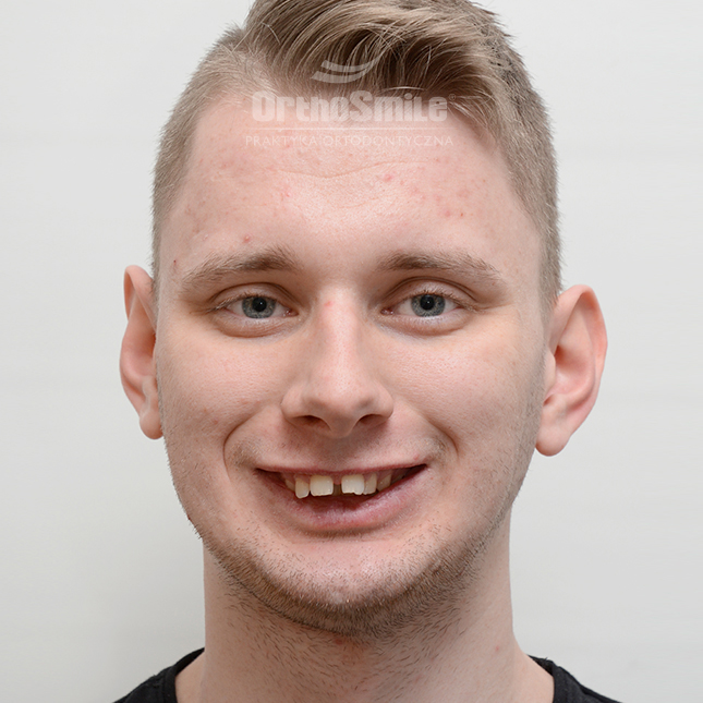 1METAMORFOZY_FOTO_OPERACYJNI_01-1_PRZED-PO_1