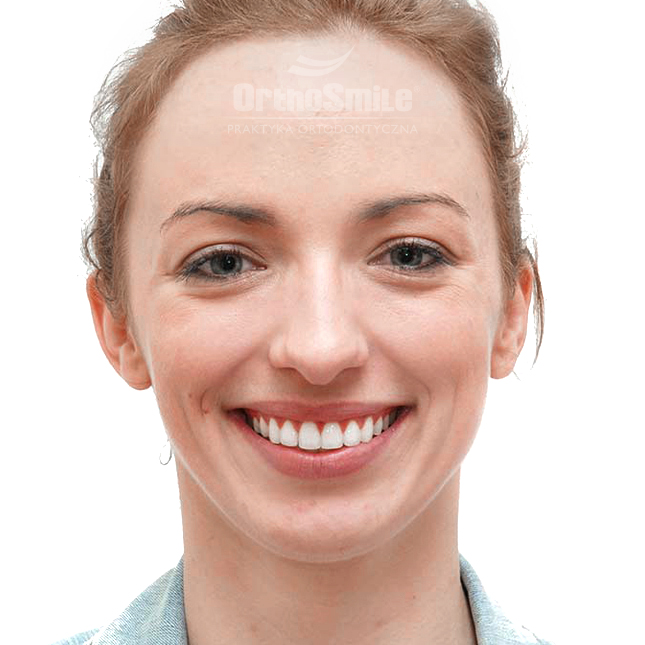 1SEKCJA 5 - FOTO_WIGET_DAMON_1_PO