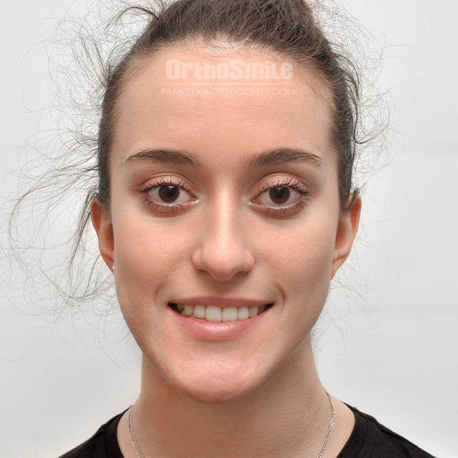 METAMORFOZY_FOTO_KOREKTA_PRZED-PO_operacyjne-1