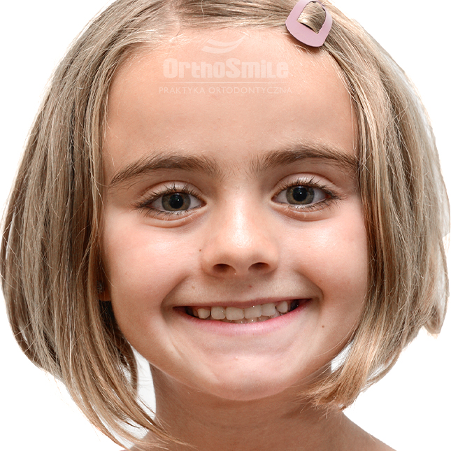 hyrax_METAMORFOZY_FOTO_KOREKTA_PRZED-PO_1